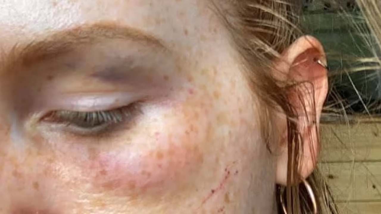 violenza subita da una ragazza