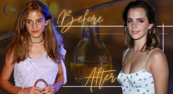 Emma Watson, la ricordi ai tempi di Harry Potter? Ecco come è cambiata